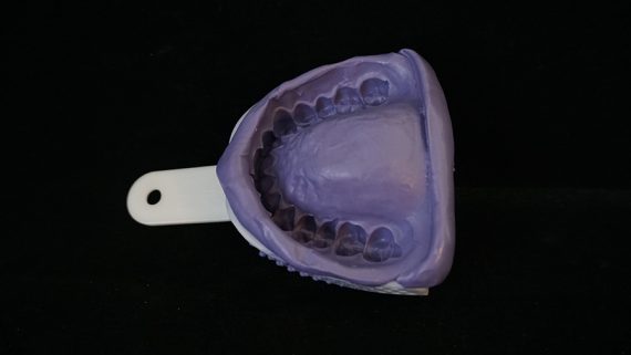 selfdentist after using trays selfdentist-after-using-trays