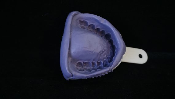 selfdentist after using trays selfdentist-after-using-trays