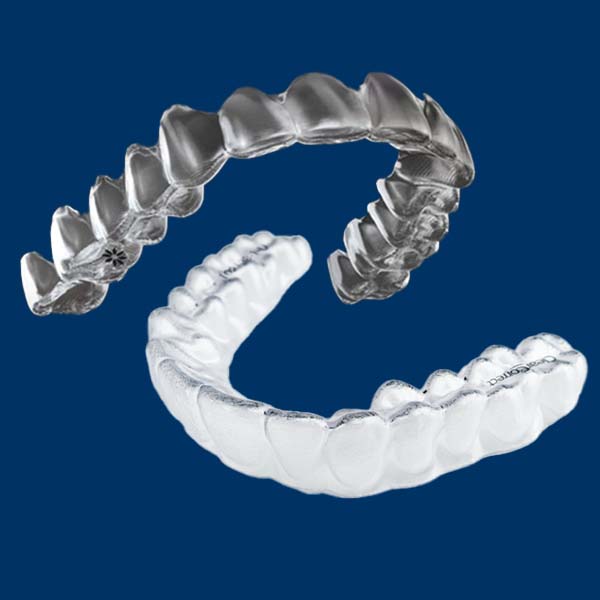 selfdentist-aligners