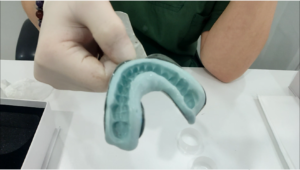 how to use dental impression kit step by step