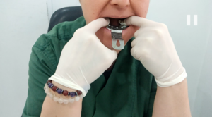 how to use dental impression kit step by step